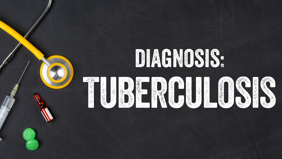 Can medical laboratories give humanity the edge over tuberculosis?
